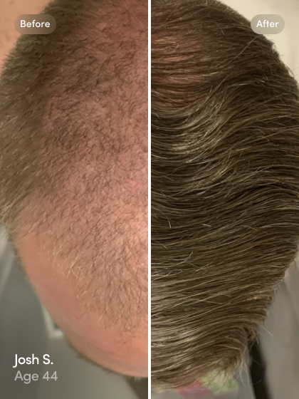 Hair Cap: Instant thicker and fuller hair