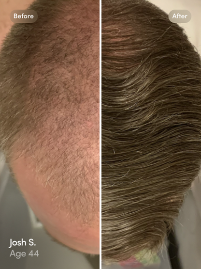 Hair Cap: Instant thicker and fuller hair